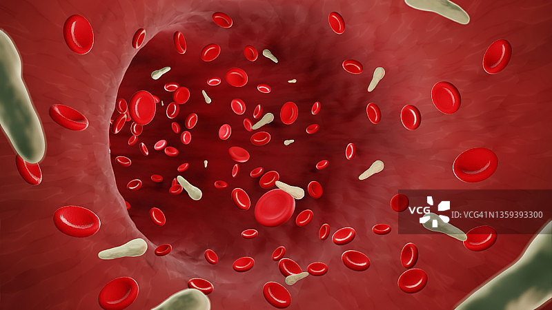 血液中的破伤风细菌插图图片素材