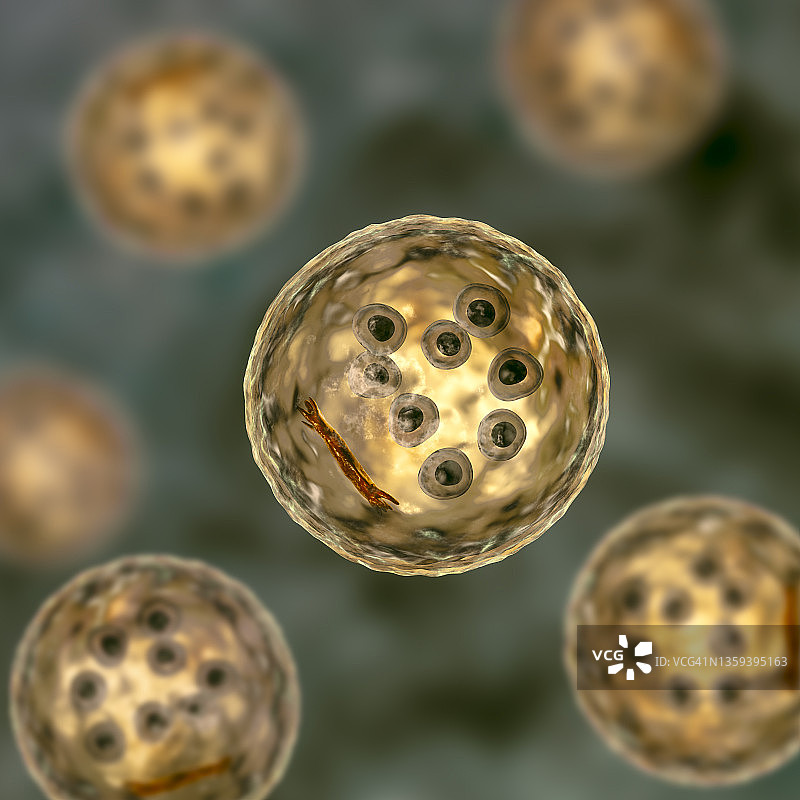 结肠内阿米巴原虫包囊，图示图片素材