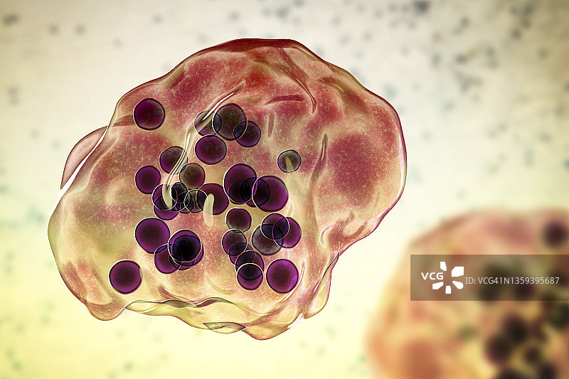 麻疹病毒感染，图示图片素材