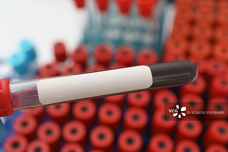 血样试管图片素材