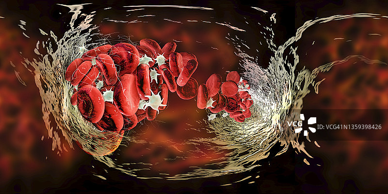 血凝块、插图图片素材