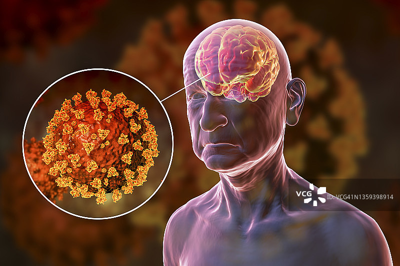 新冠疫情与痴呆症插画图片素材