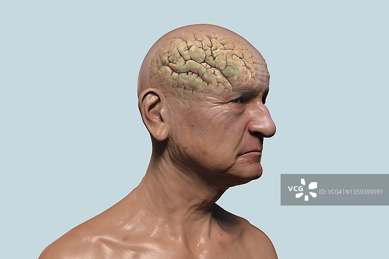 老人的大脑，图示图片素材