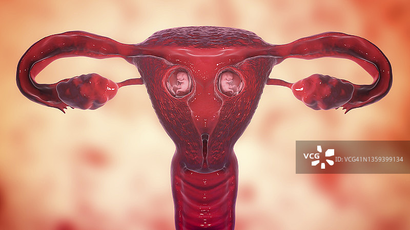 异卵双胞胎插画图片素材