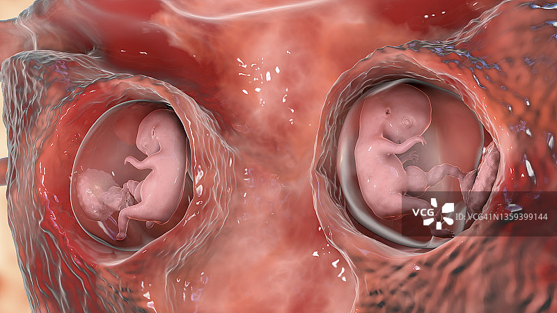 异卵双胞胎插画图片素材