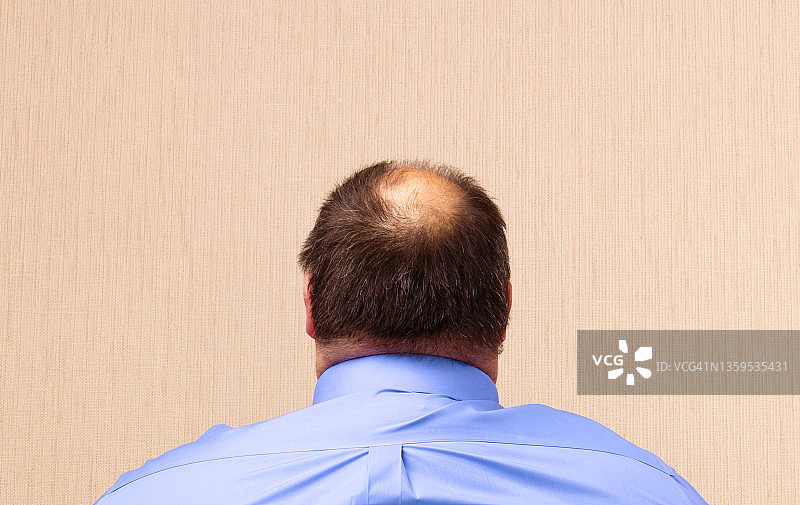 秃头男人图片素材