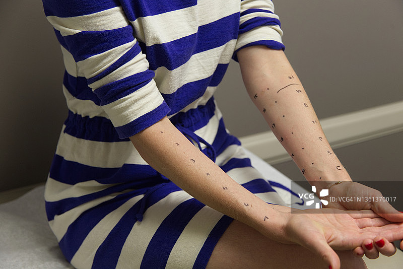 过敏测试图片素材