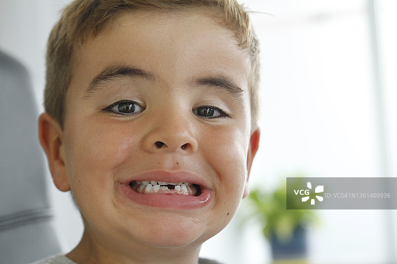 缺了牙齿的男孩肖像图片素材