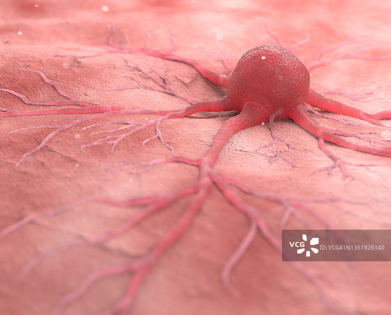 人类癌细胞图片素材