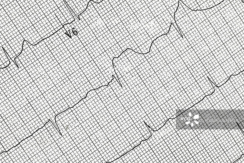 图形心电图打印输出图片素材