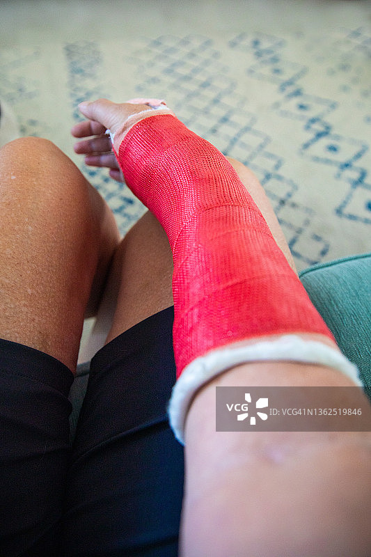 打着石膏的骨折右手腕图片素材