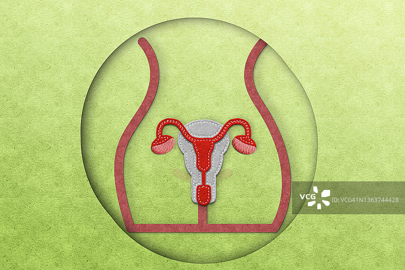 纸雕风格的多囊卵巢综合征概念图片素材