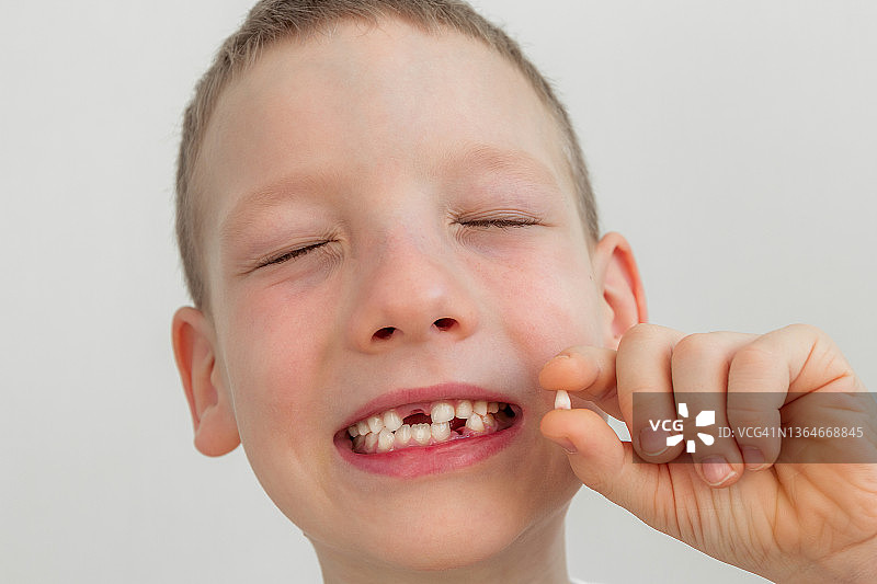 幼儿男孩眯着眼，露出掉落的乳牙和牙缝特写，在诊所看儿科牙医，牙齿健康图片素材