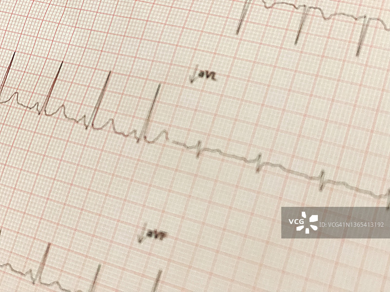 通用心电图测试报告图片素材