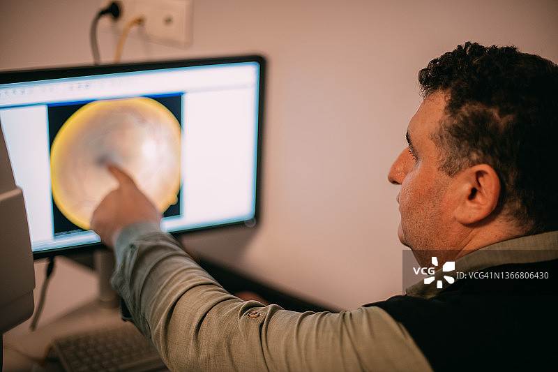 眼科医生检查视网膜图像图片素材