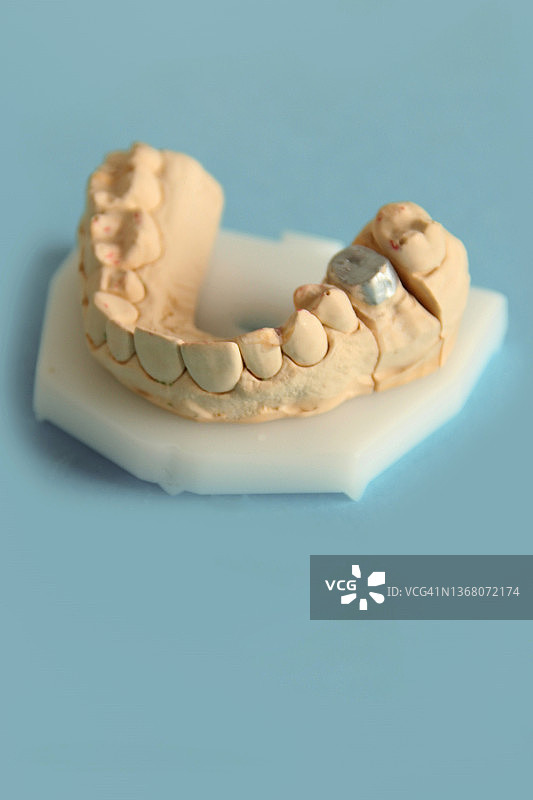 上颌牙齿模型图片素材
