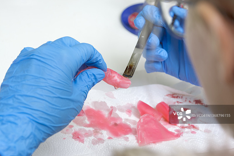 牙科修复体、假牙图片素材