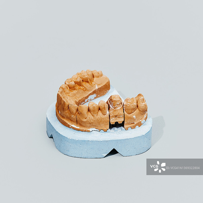 灰色背景上的牙科模具图片素材