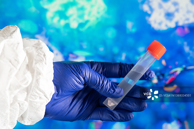 一人戴着防护手套拿着医疗样本，背景是冠状病毒图片素材