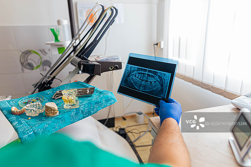 缺牙X光片图片素材