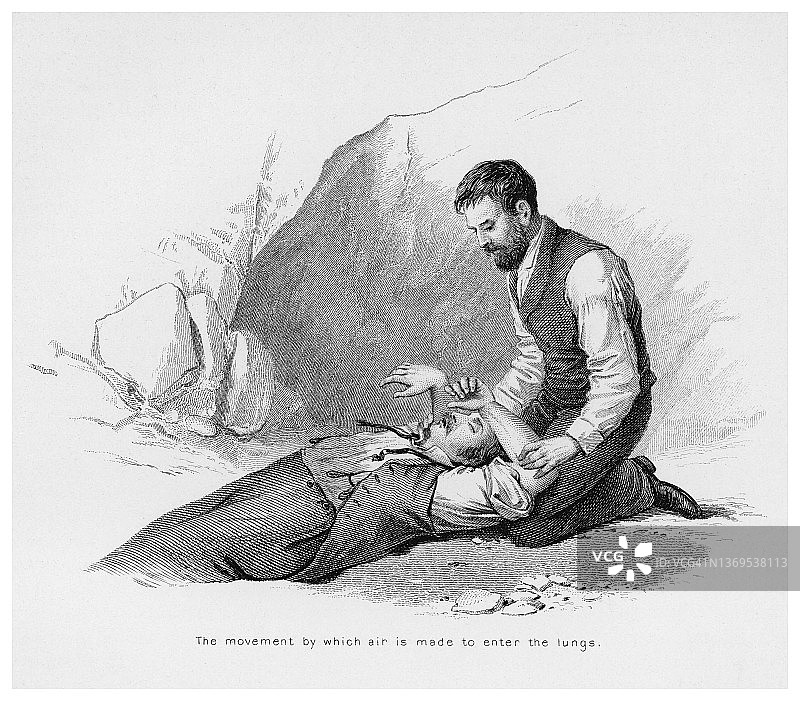 溺水或窒息恢复场景古版画图片素材