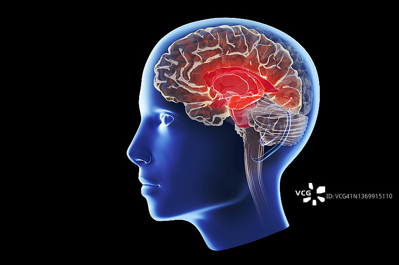 影响海马体的阿尔茨海默病图示图片素材
