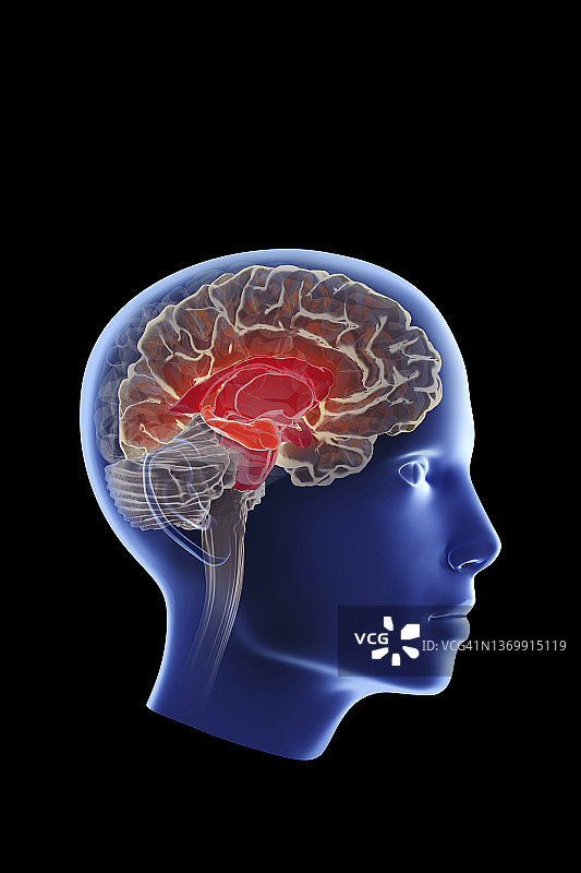 影响海马体的阿尔茨海默病图示图片素材