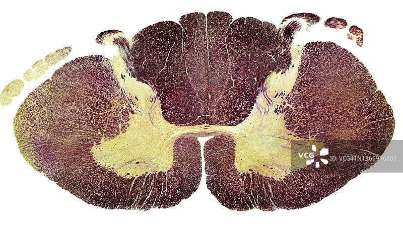 脊髓，LM图片素材