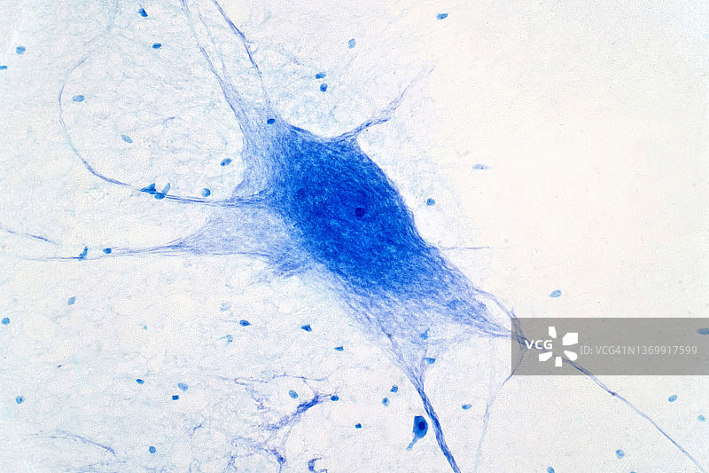 神经元细胞显微照片图片素材