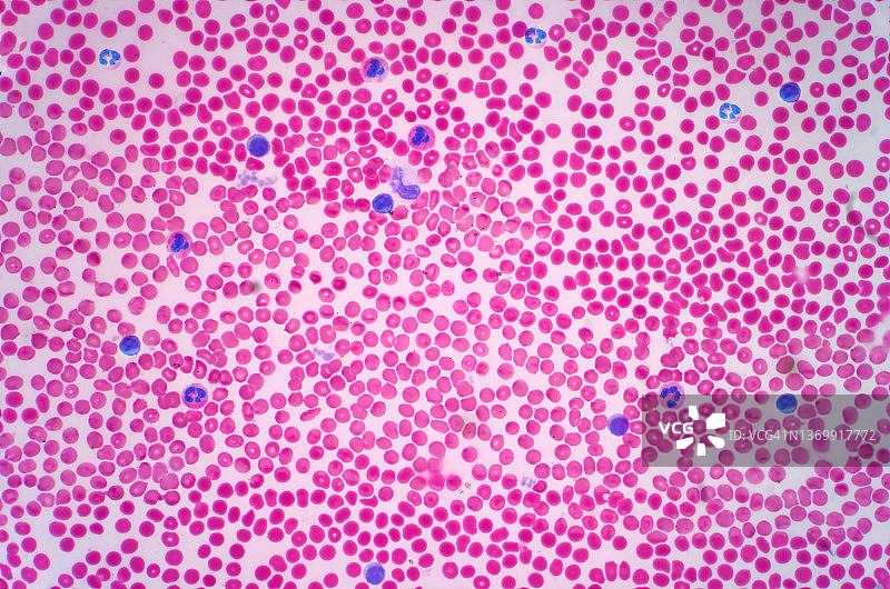 人类血细胞显微照片图片素材