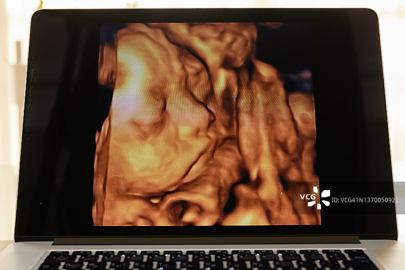 怀孕期间的胎儿照片图片素材