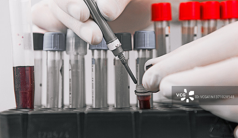 2019冠状病毒病（COVID-19）的实验室检测图片素材