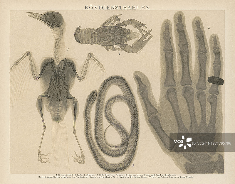 早期X射线摄影的古老雕刻插图图片素材
