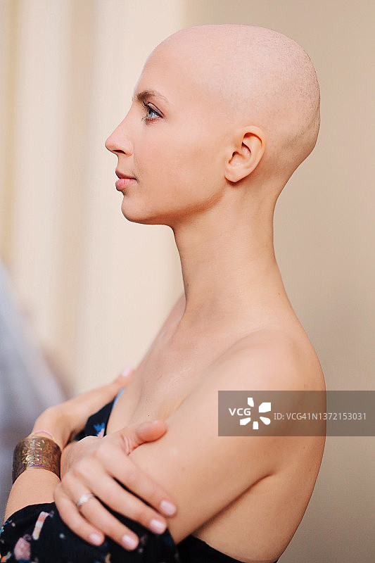 罹患癌症或秃顶的年轻女孩的侧面人像特写，战胜癌症图片素材