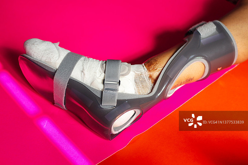 足部夹板图片素材