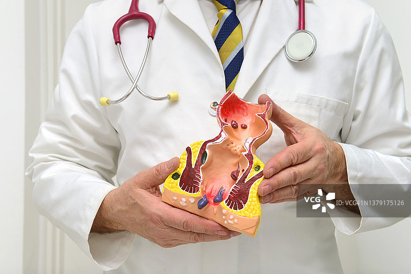 使用直肠教学模型的教授图片素材