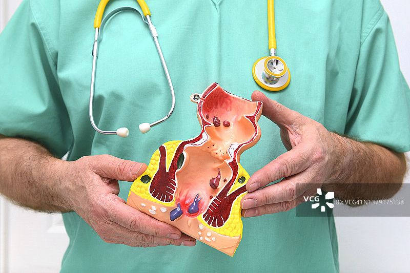 带有直肠教学模型的外科医生图片素材