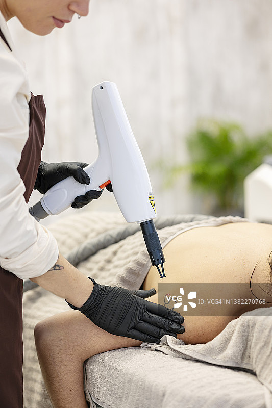 理疗师用医疗激光去除女性肩部纹身图片素材