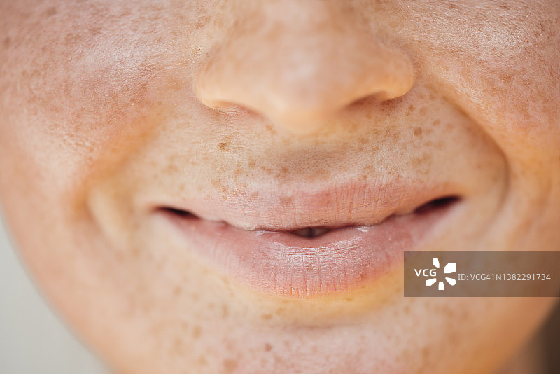 微笑女人唇部雀斑图片素材