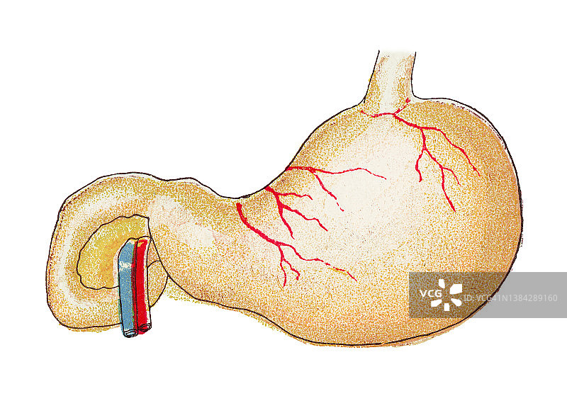 人体胃部古老彩色石印插图图片素材