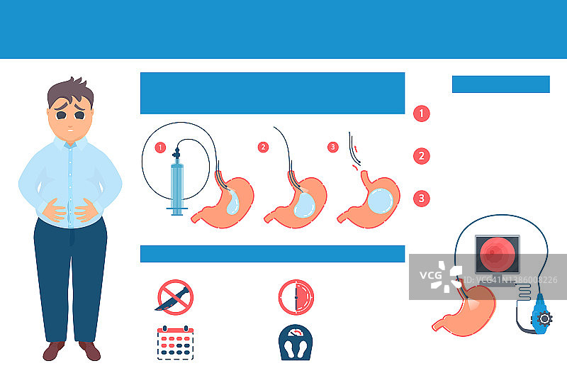 胃球囊概念图图片素材