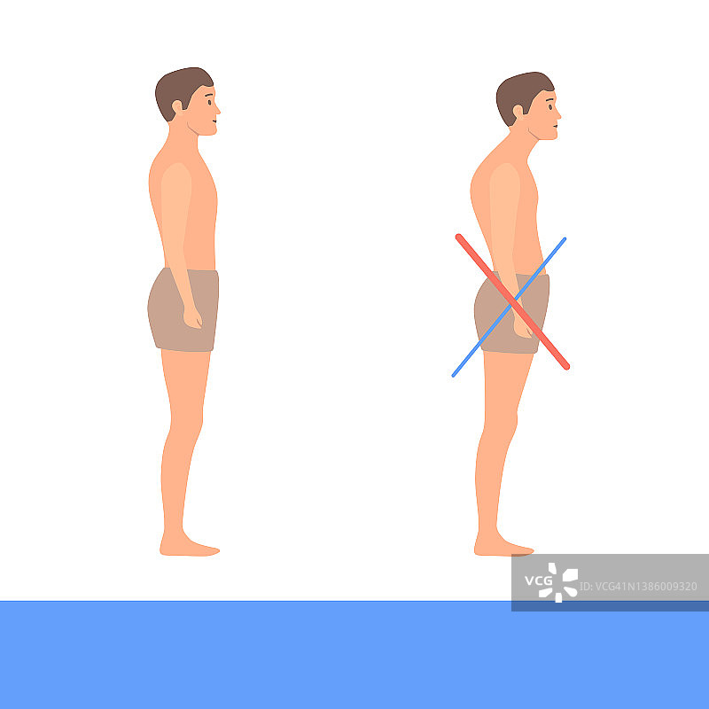 下交叉综合征概念图图片素材