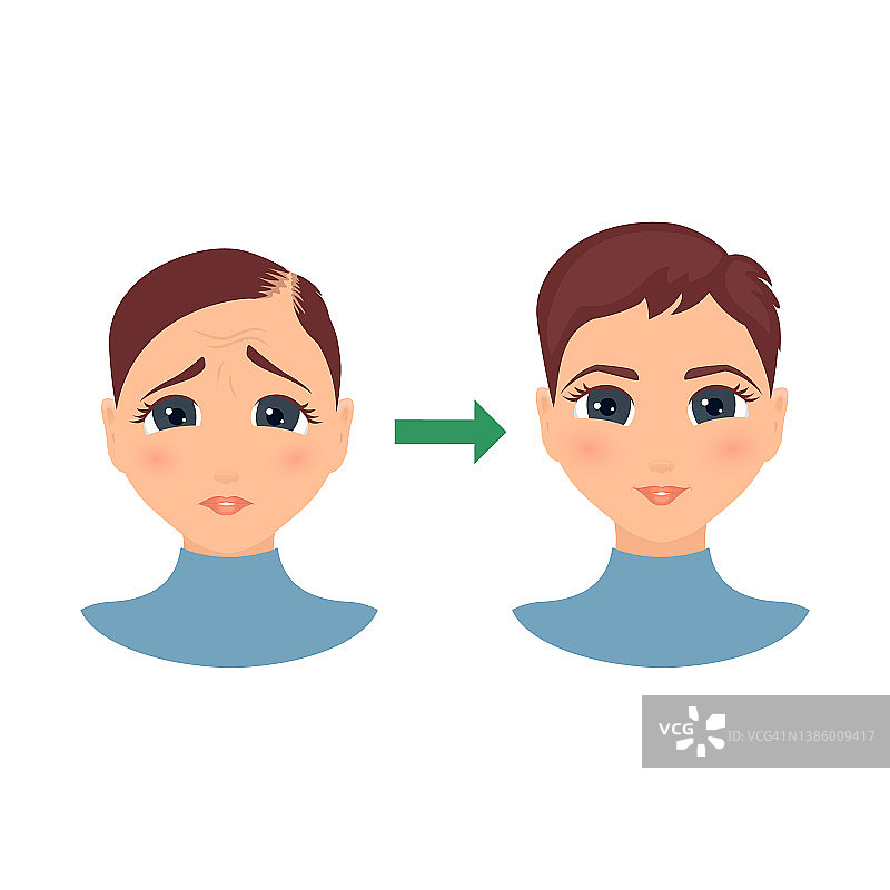 脱发治疗概念插图图片素材