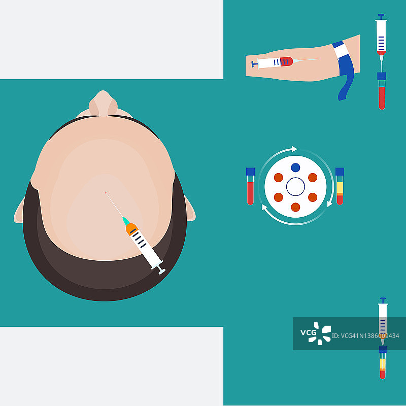 PRP头发护理插图图片素材