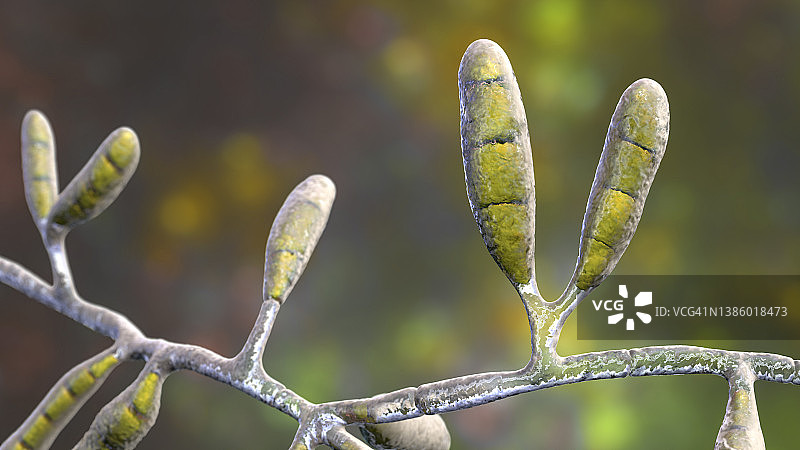 絮状表皮癣菌的皮肤癣菌，图示图片素材