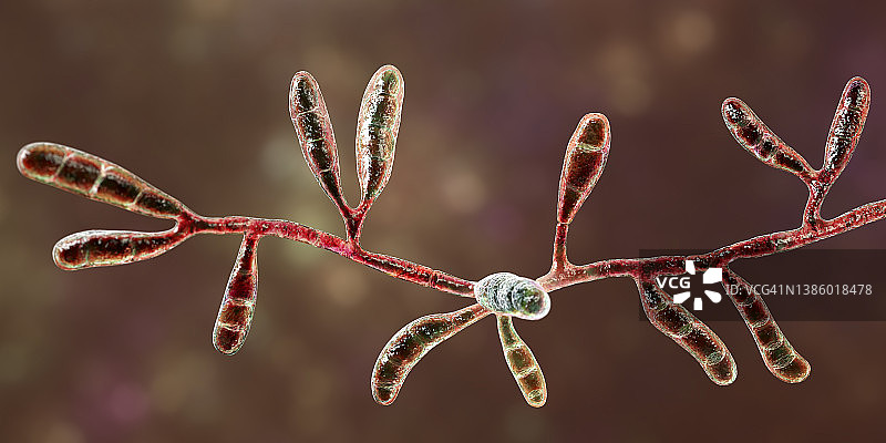 絮状表皮癣菌的皮肤癣菌，图示图片素材