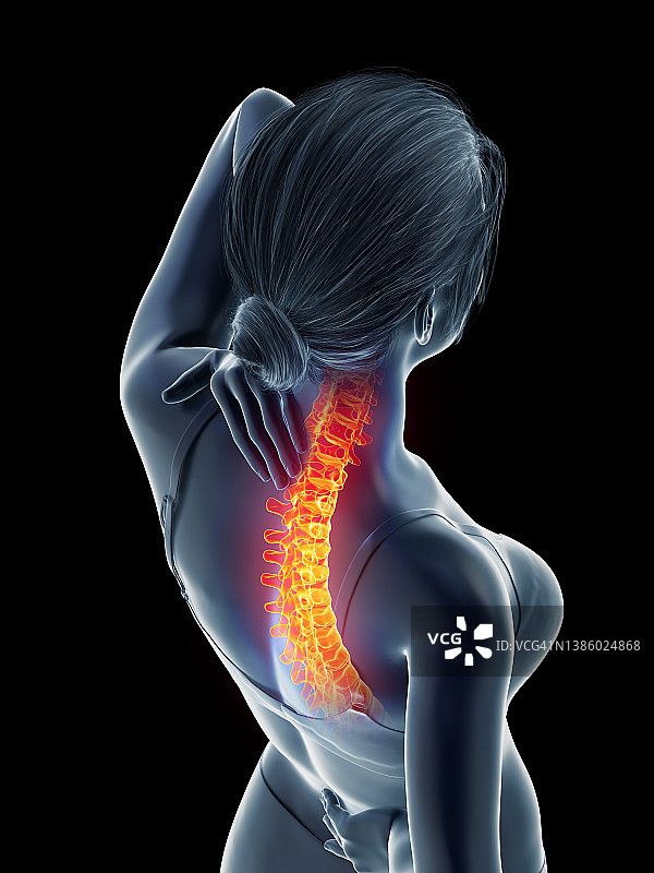 一个背痛的女人，插图图片素材