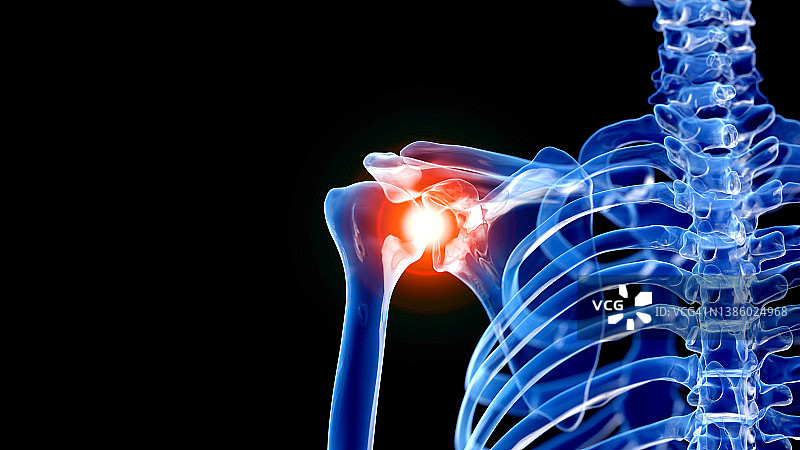 肩部疼痛插画图片素材