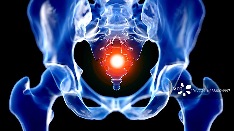 尾骨疼痛示意图图片素材