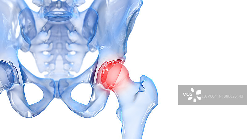 髋关节疼痛插画图片素材